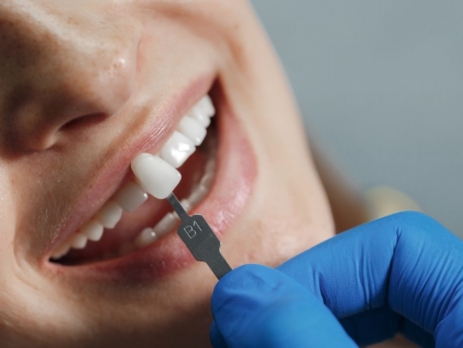 Tooth Repair with Crown Onlay