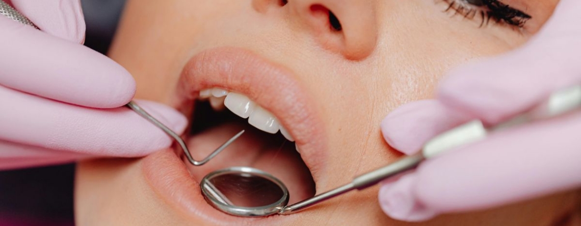 Tooth Cavity Treatment