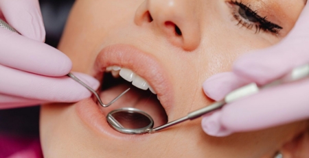 Tooth Cavity Treatment